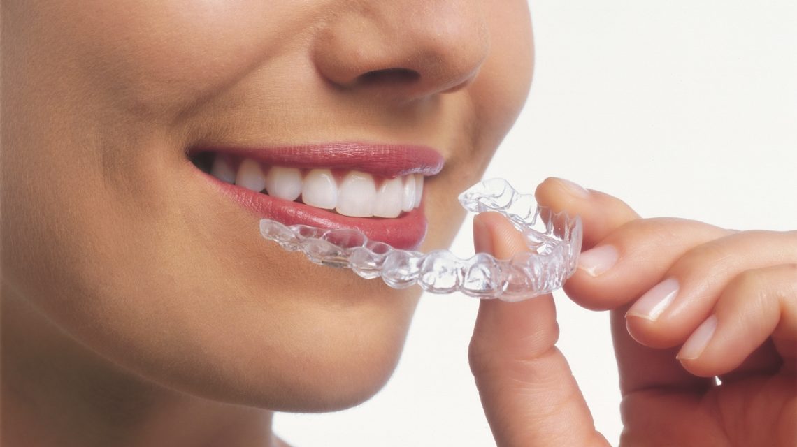 Clear Aligner Therapy - Lemala Dental | dental group